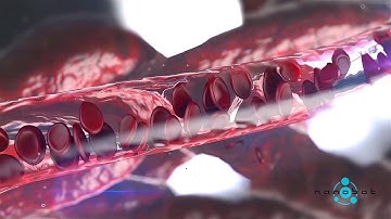 What is retinal ischemia?