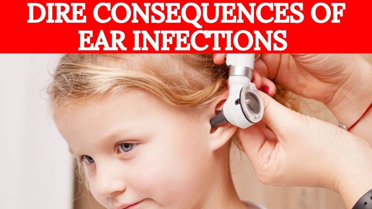 👂 How Chronic Childhood Ear Infections Delay Language Development 👂
