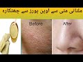 How to get rid open pores on face at home by mahnoor yousaf