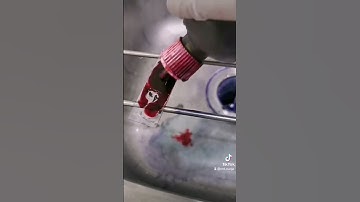 How infection looks like? #laboratory #medtech #microscope #mls #cls #microbiology #vaginalswab #mt