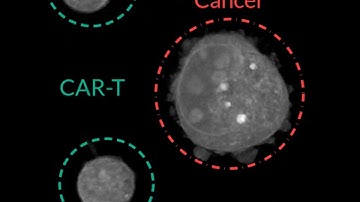 [Holotomography] CAR T-cells attacking a cancer cell