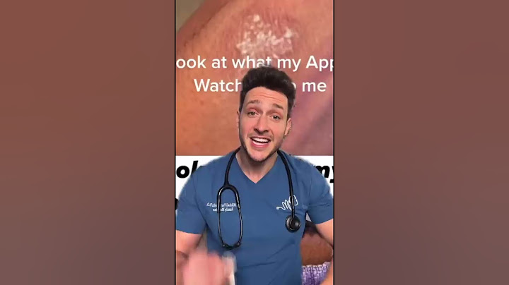 Apple Watch Users, Beware!
