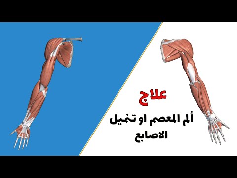 تمرين واحد بسيط و سحري لكل من يعاني من الم الساعد النفق الرسغي التهاب اوتار اليد