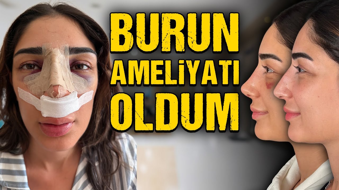 İki Haftalık Tüm Süreç | ÖNCESİ & SONRASI 👃 