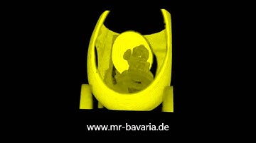 Surprise Egg Scanning using Ultra Short Echo Time MRI
