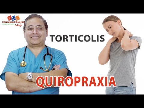 Vídeo: Tortícolis Espástica - Tratamiento, Pronóstico