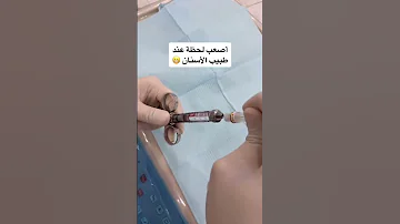 اصعب لحظة عند طبيب الأسنان Dentistdoctor Gülüşestetiği Doctor Hollywood Smile ابتسامة ابتسامة 