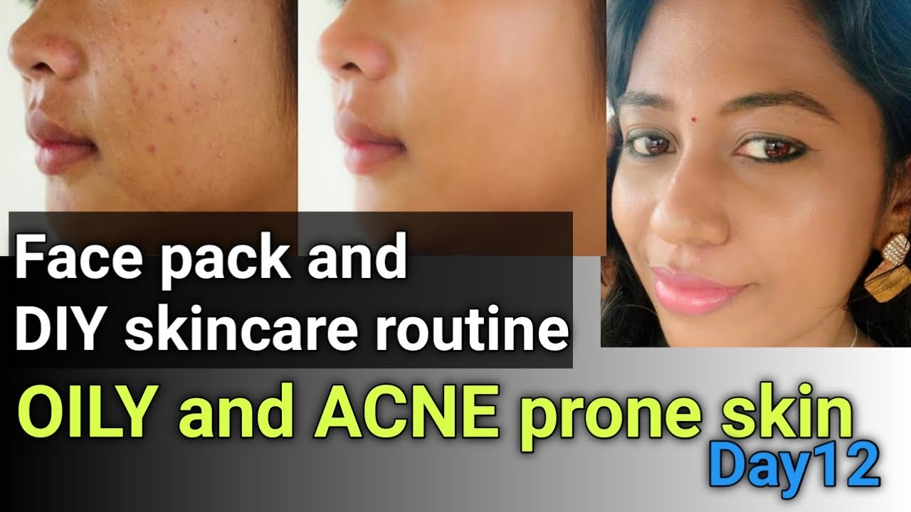3 Effective home remedies to remove ACNE100 worksskincare for OILY