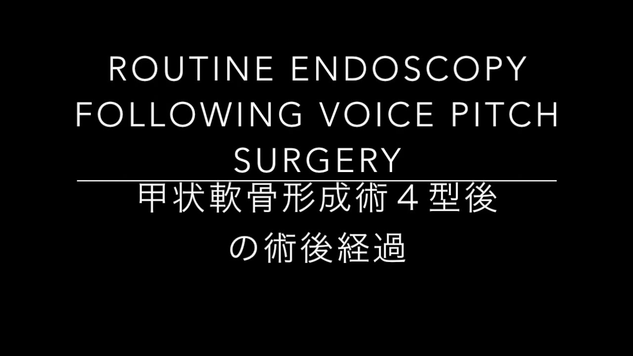 4 Routine Endoscopy Following Voice Pitch Surgery YouTube 4-routine-endoscopy-following-voice-pitch-surgery-youtube