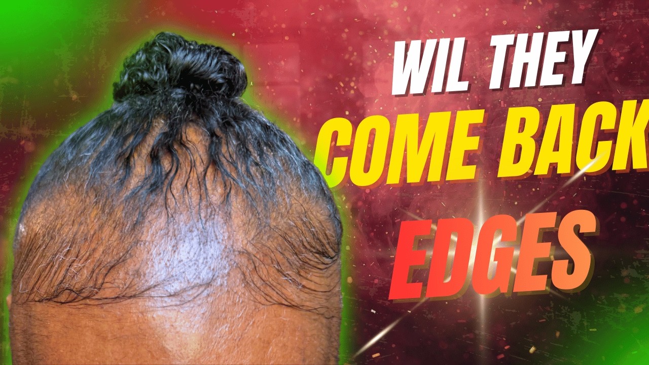 📈 Edge Regrowth Journey: My REAL truth about hair loss and the simple plan I used to grow it back