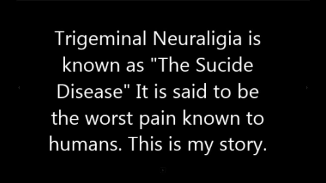 What is trigeminal neuralgia?