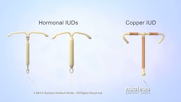 What is an IUD?
