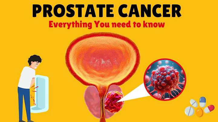 Prostate Cancer – Causes, Signs and Symptoms, Diagnosis & Treatment