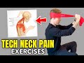 Effective Exercises for Alleviating Tech Neck Pain and Improving Posture