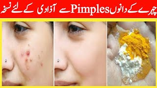 chehre ke dano pimple se nijat in Hindi Urdu|Fayde Hi Fayde|