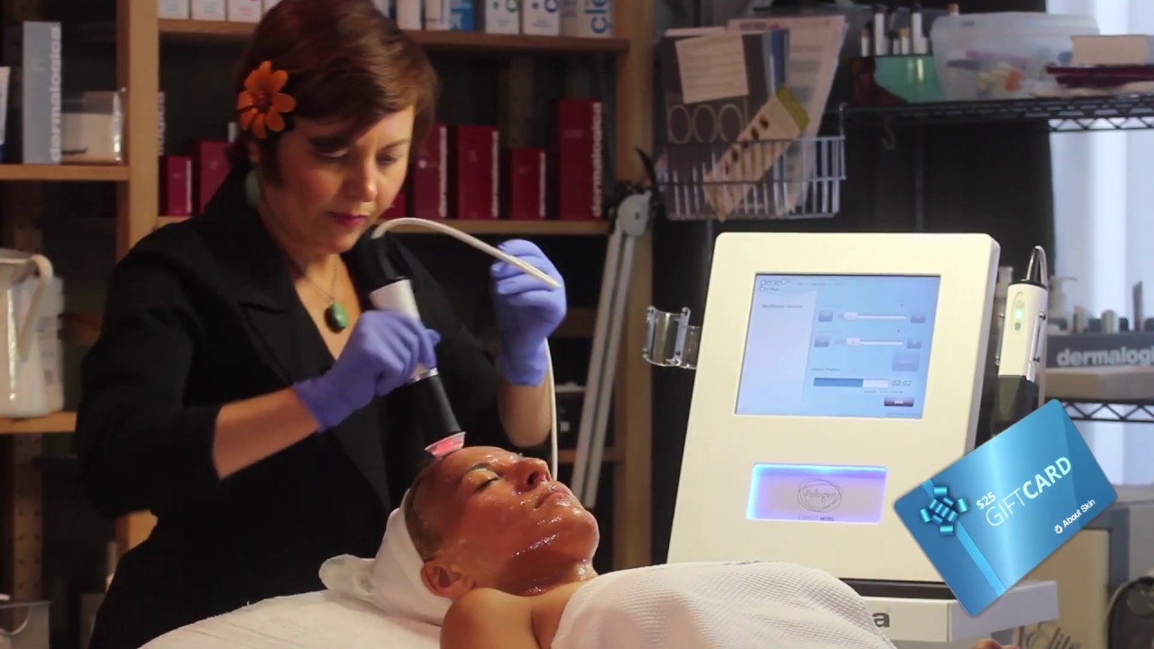 Microdermabrasion Facial Treatment - Orange County, CA