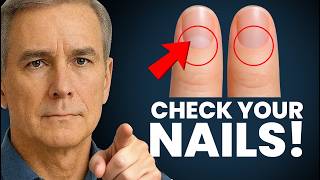 Look At Your Nails Right Now — This Could Explain Everything Doctors Missed