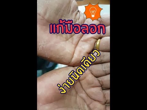 แก้มือลอกง่าย !!