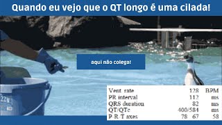 Cuidado com o QT longo - veja essa cilada e evite cair nela!