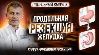 ПРОДОЛЬНАЯ РЕЗЕКЦИЯ ЖЕЛУДКА • SLEEVE • СЛИВ • РУКАВНАЯ РЕЗЕКЦИЯ • схема операции, технические нюансы