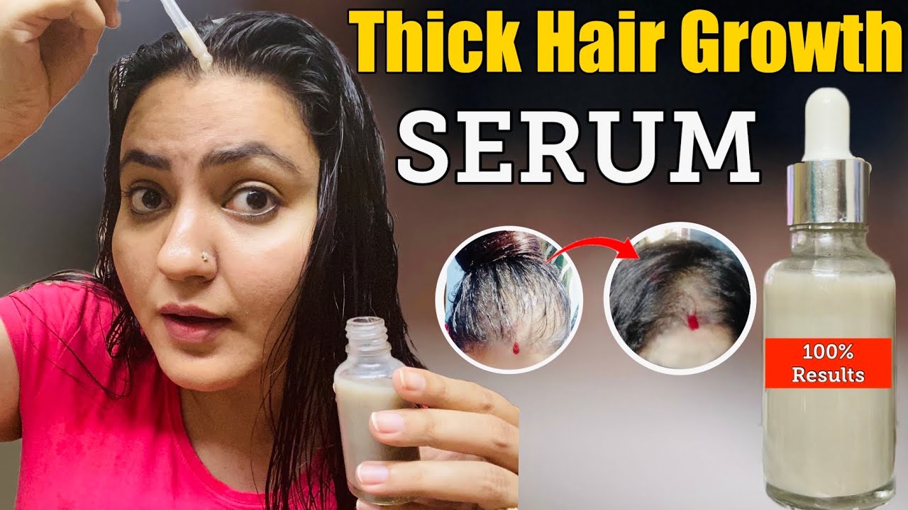 DIY Thick Hair Growth Serum : घर पर हल्के बालों को करें घना 100%👍🏻, उगाएँ  Hairline, Bald Patches - YouTube