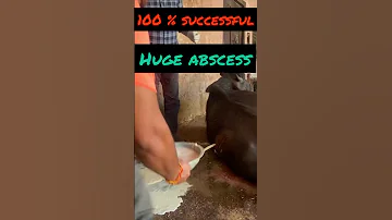 Huge Abscess L Dr Umar Khan 