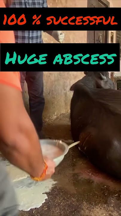 Huge abscess l Dr umar khan