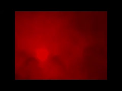 Body Dysmorphobia REDUX | Teaser Trailer