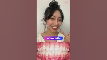 RĂNG KHỂNH – GIỮ LẠI HAY NIỀNG THẲNG?