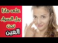 كل ما عليك معرفته عن سواد تحت العين 
