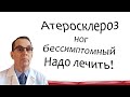 Атеросклероз артерий ног бессимптомный. Как лечить? Видеобеседа для ВСЕХ.