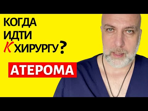 Атерома (жировик и киста) - когда идти к хирургу | Доктор Елизаров: удаление атеромы лазером