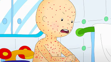 Chicken Pox | Caillou Cartoon