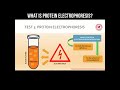 What is protein electrophoresis? #protein #electrophoresis