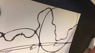 Release of Trauma technique using Neurographica method