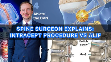 Spine Surgeon Explains: Intracept Procedure vs ALIF Surgery