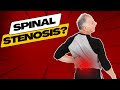 Top 3 Symptoms of Spinal Stenosis