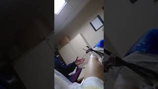 Fibula Talus Kopuk Ayak Ameliyat Çıkışı