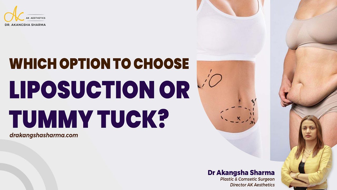 When to Choose Liposuction vs. Tummy Tuck