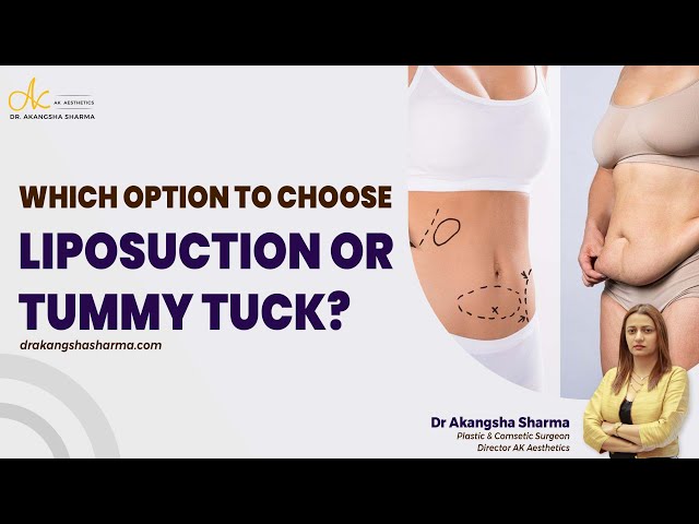 Which option to choose liposuction or tummy tuck?