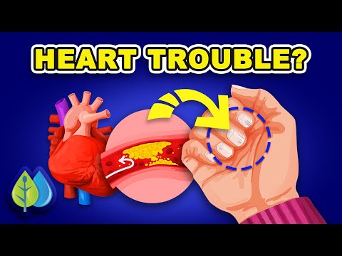Your Hands Reveal 5 Heart Disease Symptoms