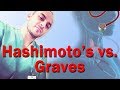 Hashimoto's vs. Graves' Disease (11/25/2012 QOTD)