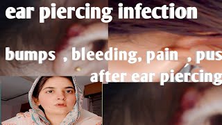 Ear piercing infection || side effects of gun ear piercing|| some precautions for ear piercing