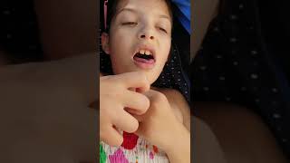Complex Partial Seizure With Secondary Generalization 27.06.2021