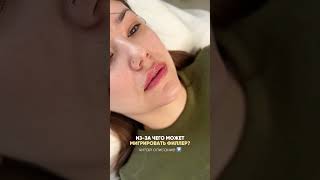 читайте описание 😱😱 #косметолог #губы #филлеры #миграцияфиллера