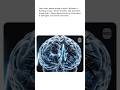 Your Brain Without Sleep 🧠⚠️#brain #shortsviral #sleep