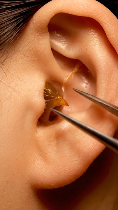 ASMR Deep Ear Cleaning – Relaxing Macro Session (No Talking)