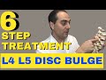6 Step L4 L5 Disc Bulge Treatment L4 L5 Bulging Disc Treatment by Dr. Walter Salubro