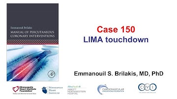 Case 150: PCI Manual - LIMA touchdown