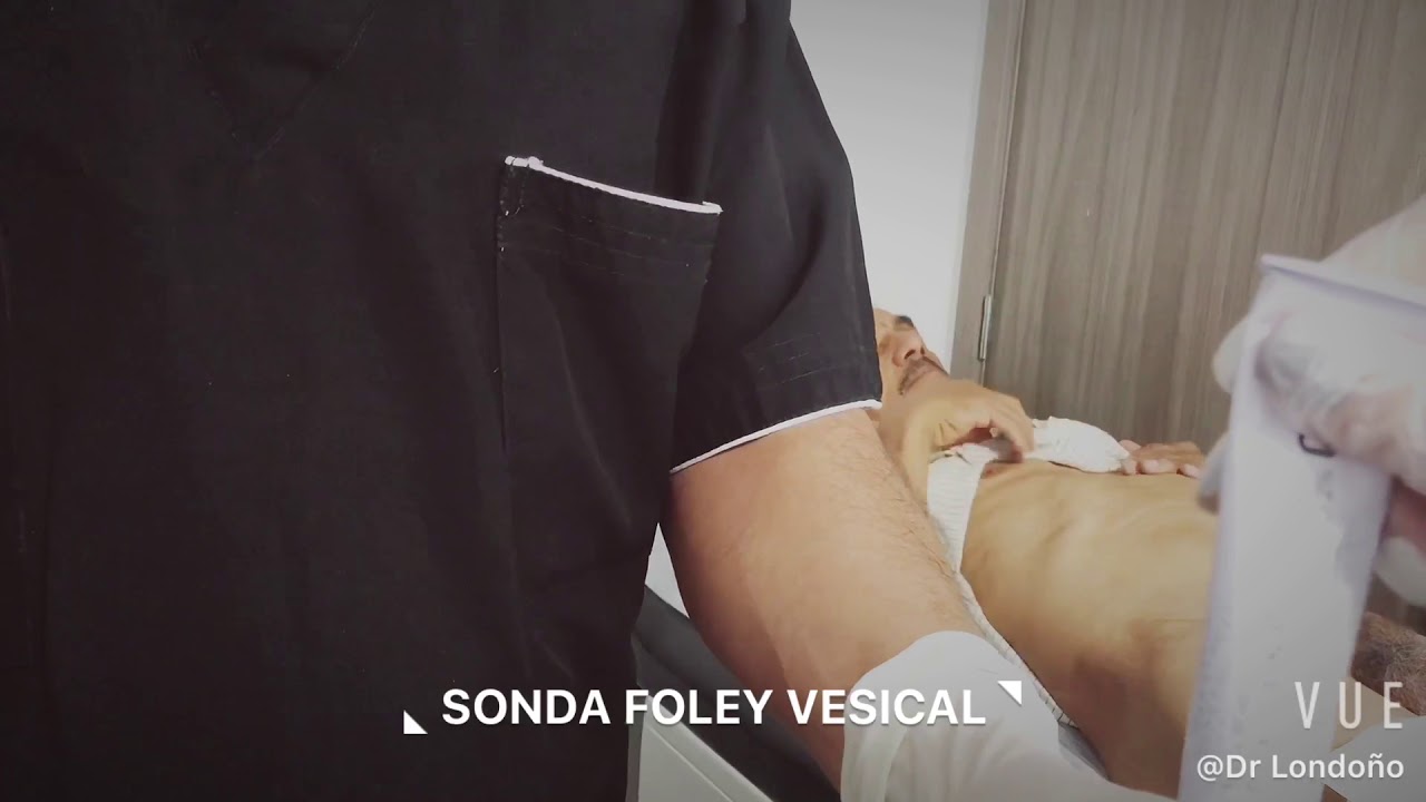 Para que sirve la sonda foley